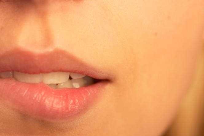 Białe krostki na ustach - przyczyny, objawy i skuteczne metody leczenia