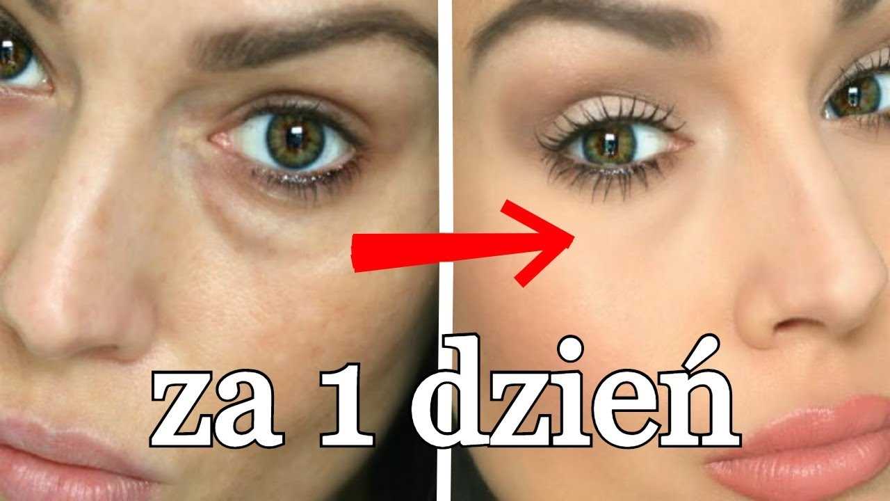 Krem pod oczy na cienie - skuteczne sposoby na pozbycie się cieni pod oczami | Porady dla pięknej skóry oczu 3 Spożywanie warzyw i owoców bogatych w witaminę C
