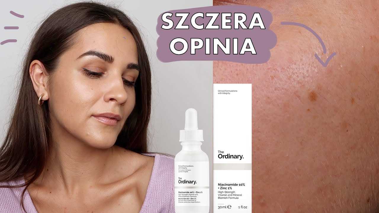 Kontrola nadmiernego wydzielania sebum